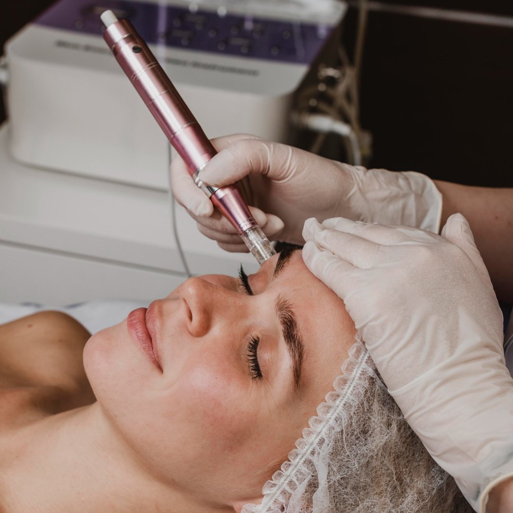 Studená plazma – kosmetické ošetření pleti